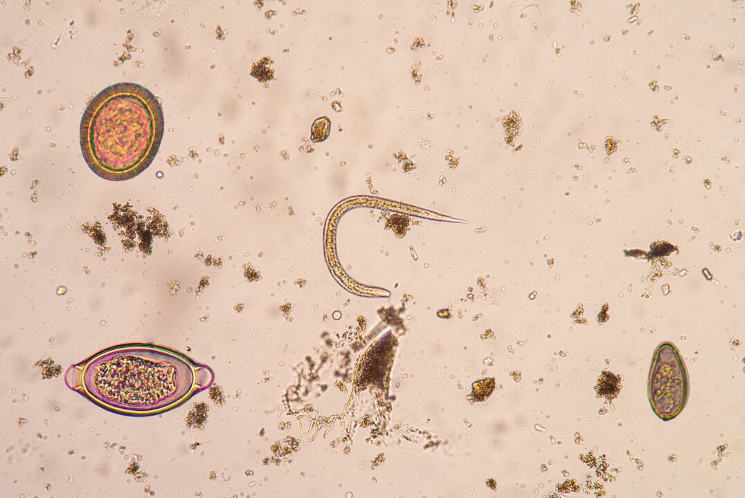 Stadij larve potkožnih parazita
