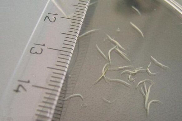 kako izgledaju pinworms