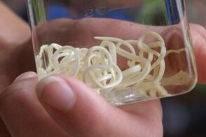 parazita iz ljudskog tijela