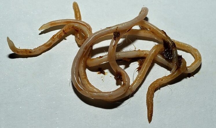 toksokara iz ljudskog tijela